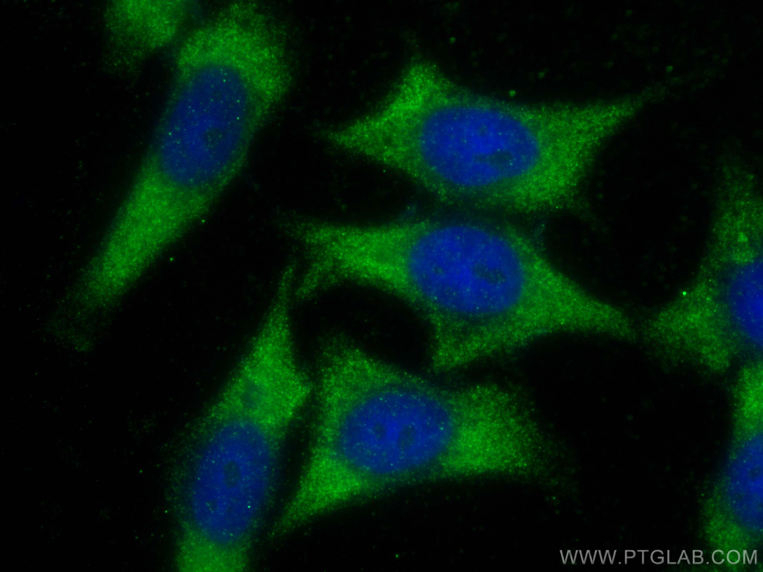 Immunofluorescence (IF) / fluorescent staining of HepG2 cells using TMEM200A Polyclonal antibody (25378-1-AP)