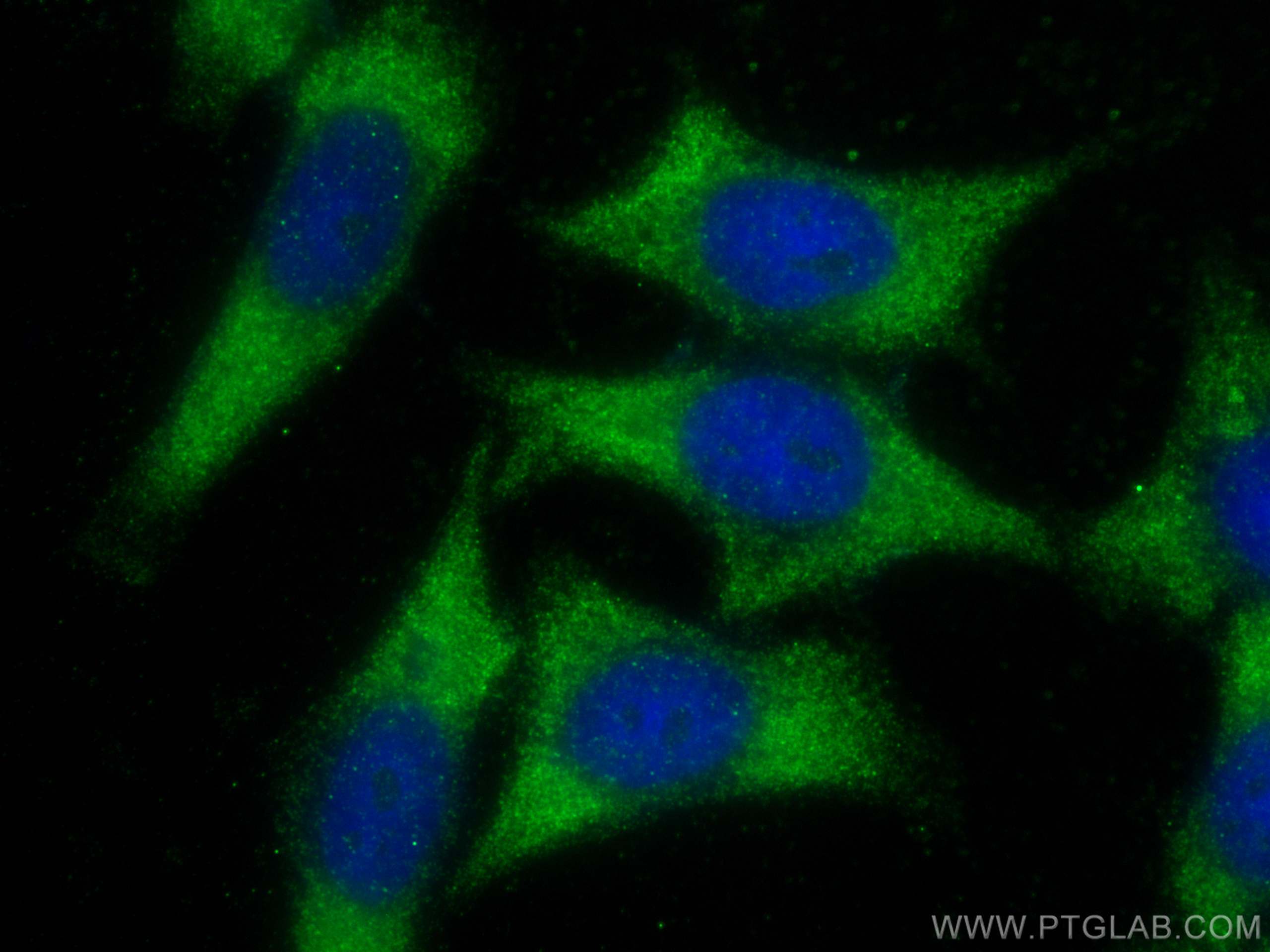 IF Staining of HepG2 using 25378-1-AP