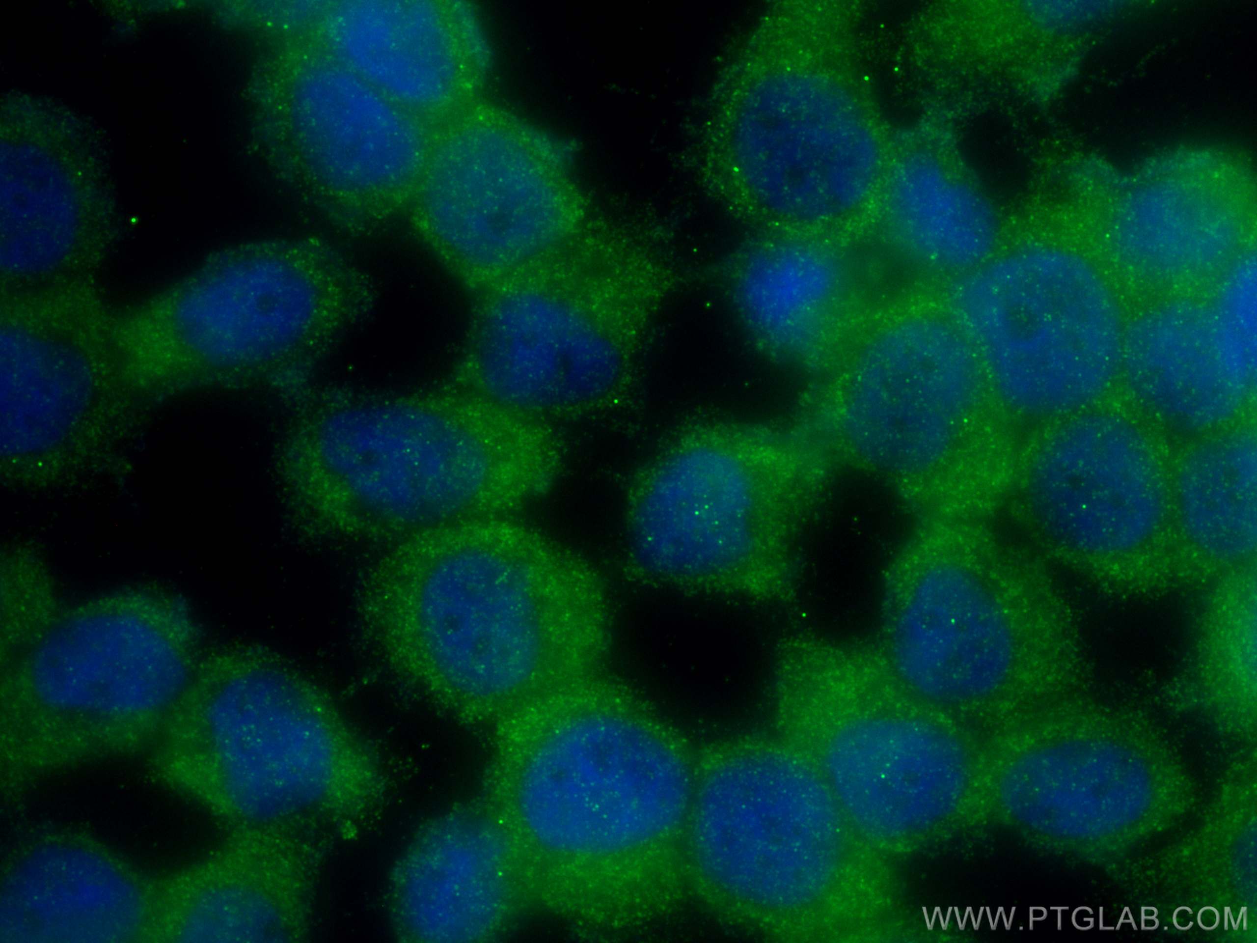 Immunofluorescence (IF) / fluorescent staining of NCCIT cells using TMEM200A Polyclonal antibody (25378-1-AP)
