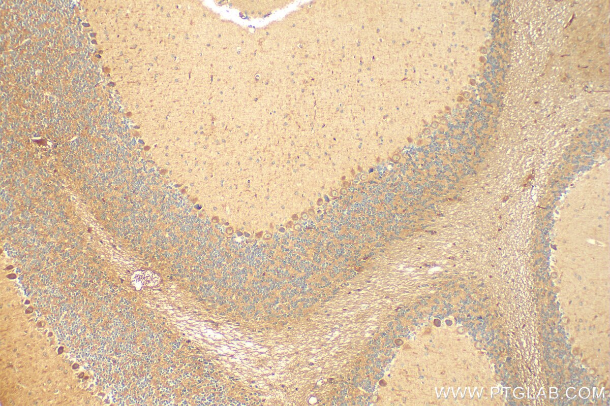 Immunohistochemistry (IHC) staining of mouse cerebellum tissue using TMEM200A Polyclonal antibody (25378-1-AP)