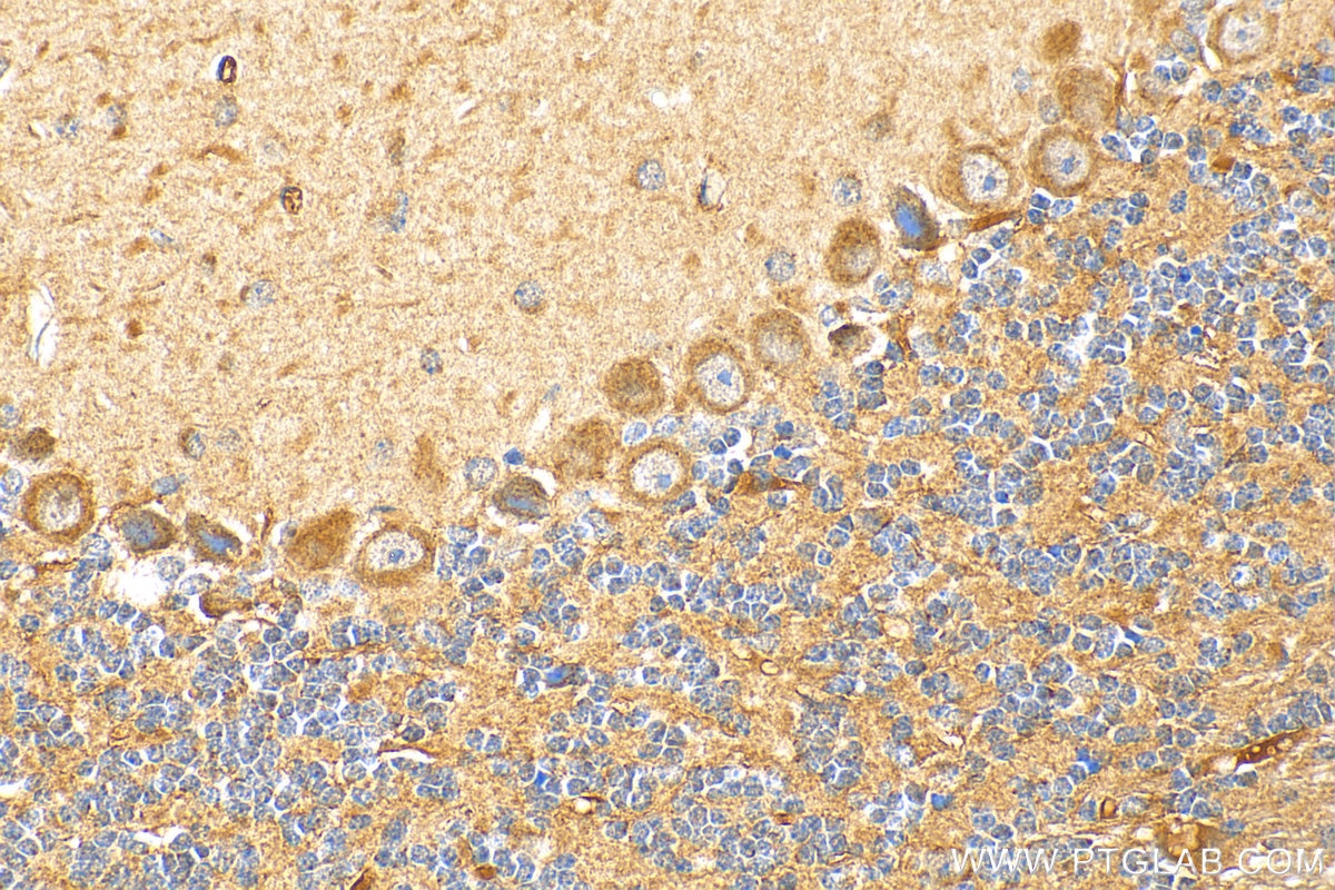 Immunohistochemistry (IHC) staining of mouse cerebellum tissue using TMEM200A Polyclonal antibody (25378-1-AP)