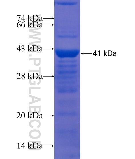 TMEM200A fusion protein Ag21958 SDS-PAGE