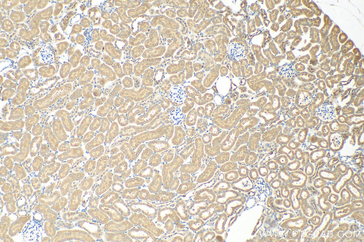 Immunohistochemistry (IHC) staining of mouse kidney tissue using TMEM200C Polyclonal antibody (28596-1-AP)