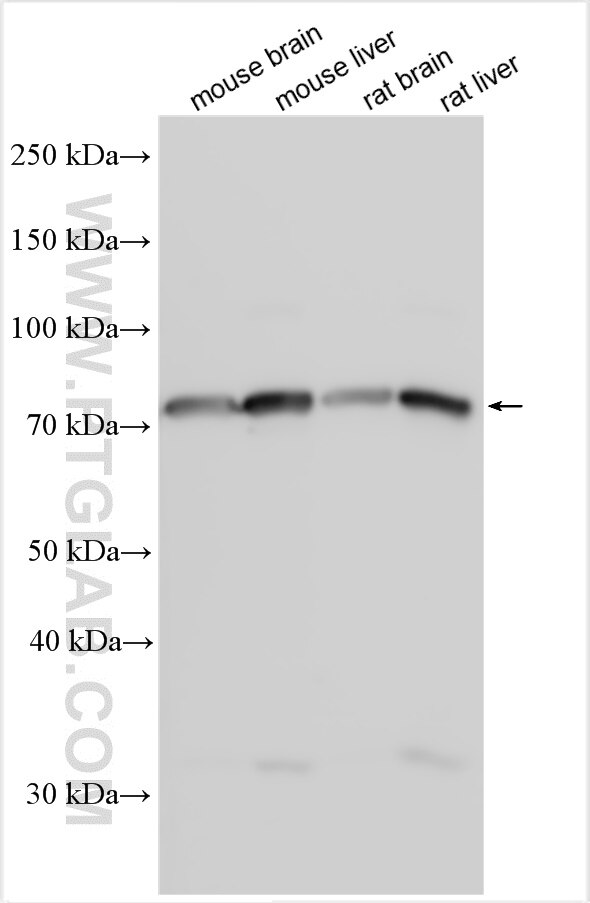 Western Blot (WB) analysis of various lysates using TMEM200C Polyclonal antibody (28596-1-AP)