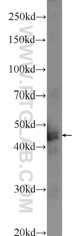 Western Blot (WB) analysis of mouse brain tissue using TMEM201 Polyclonal antibody (24092-1-AP)