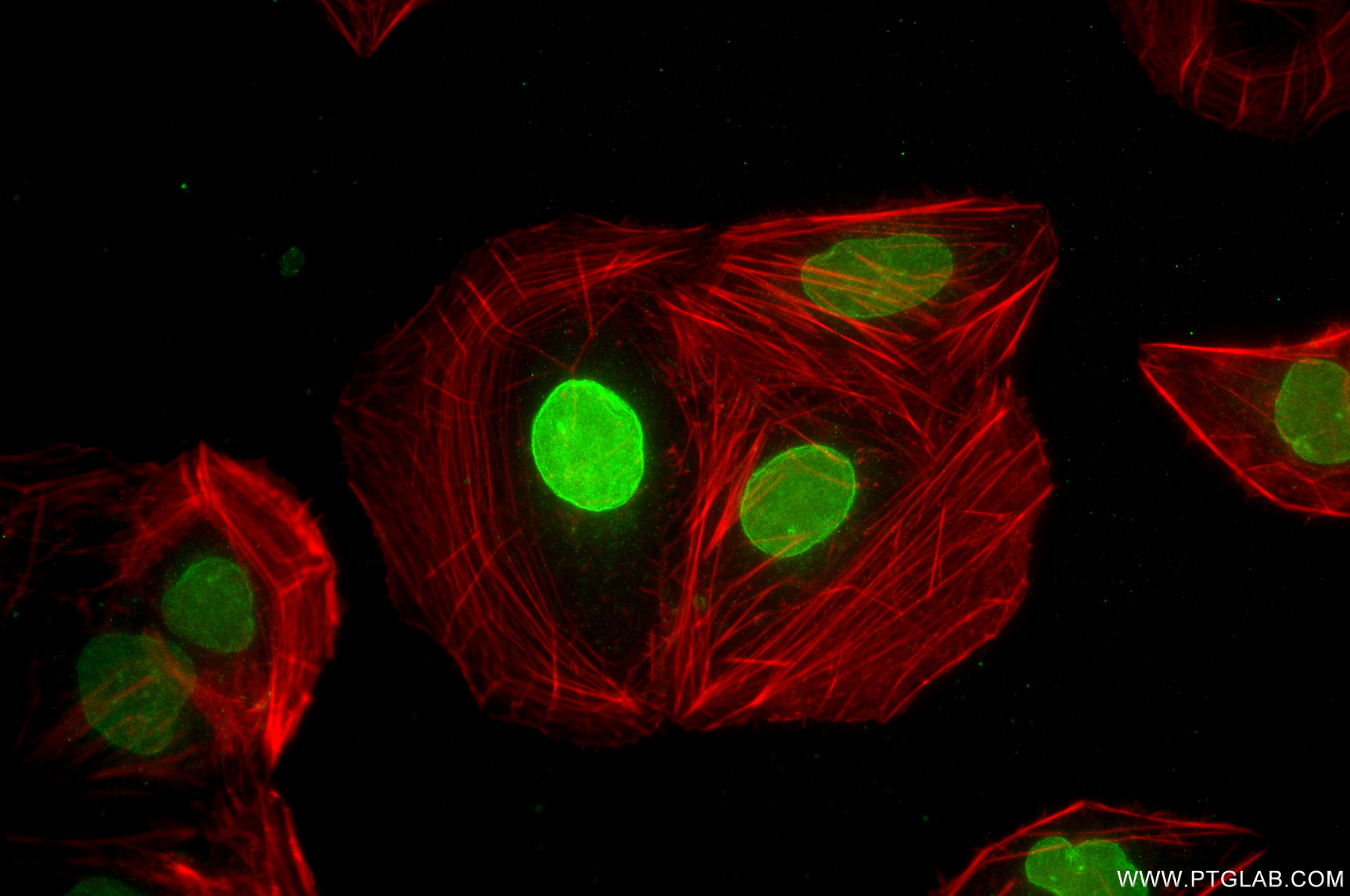 Immunofluorescence (IF) / fluorescent staining of U2OS cells using TMEM201 Recombinant monoclonal antibody (87333-1-RR)