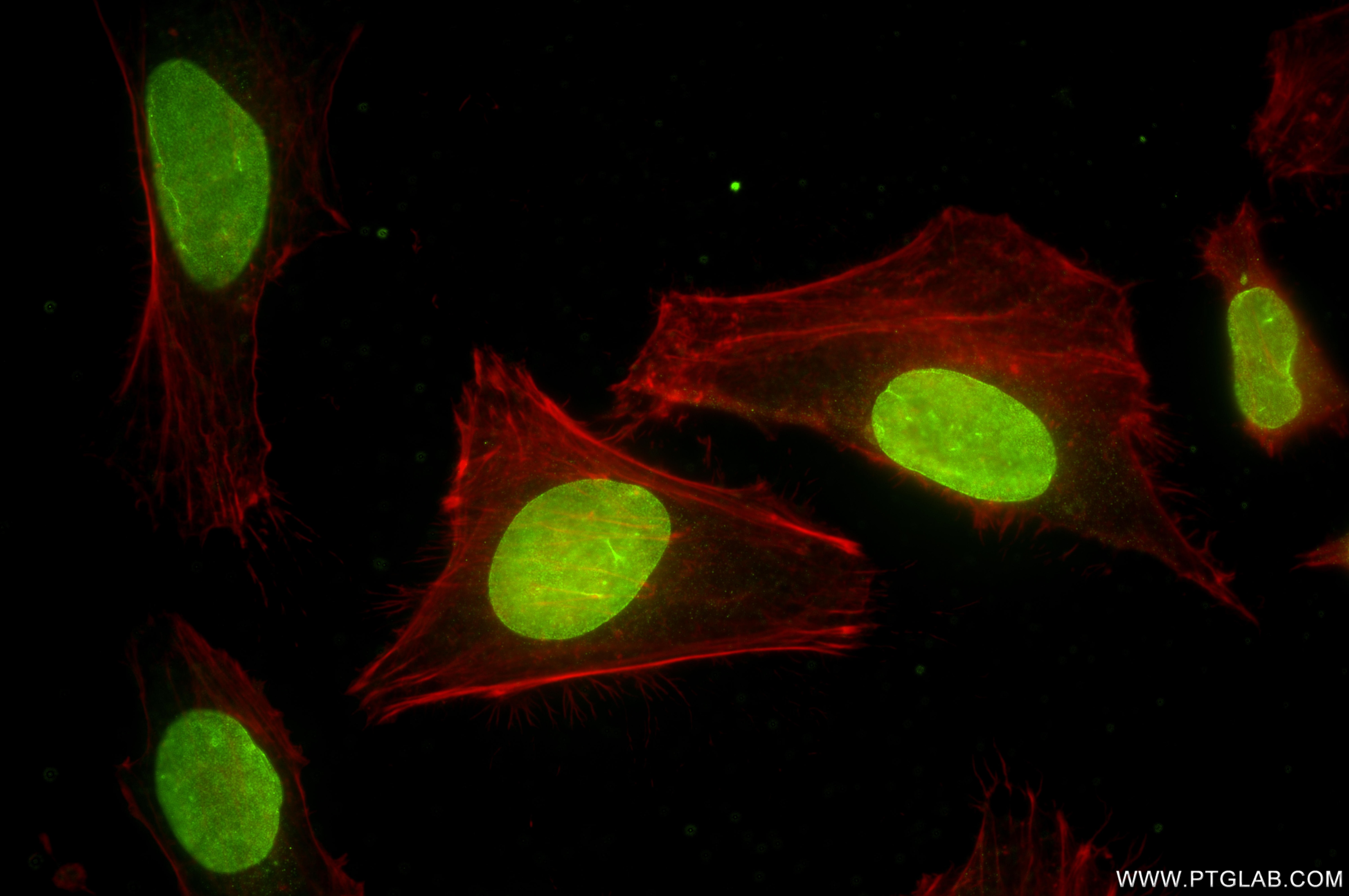 Immunofluorescence (IF) / fluorescent staining of HeLa cells using TMEM201 Recombinant monoclonal antibody (87333-1-RR)