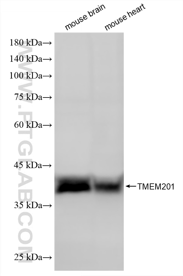 Western Blot (WB) analysis of various lysates using TMEM201 Recombinant monoclonal antibody (87333-1-RR)