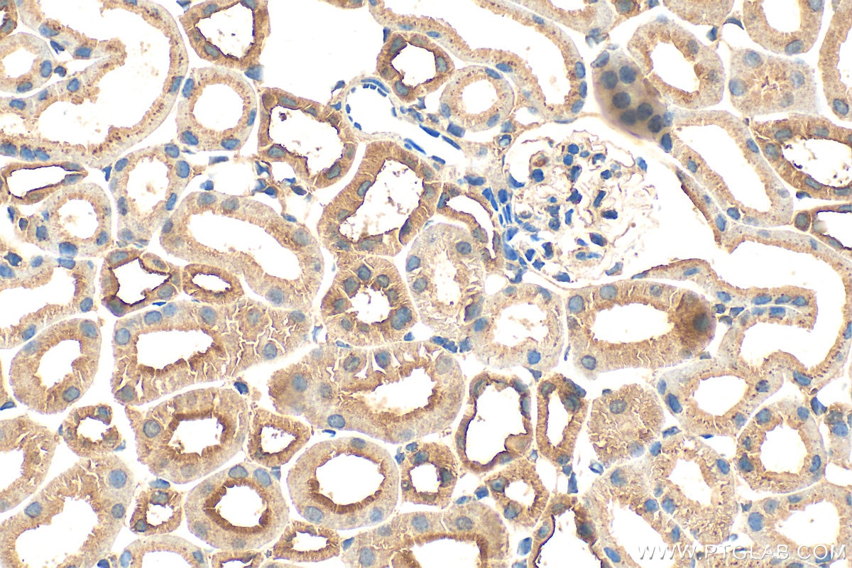IHC staining of mouse kidney using 20479-1-AP Immunohistochemistry (IHC) staining of mouse kidney tissue using TMEM204 Polyclonal antibody (20479-1-AP)
