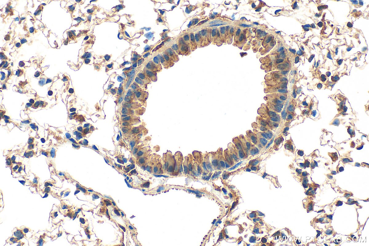 IHC staining of mouse lung using 20479-1-AP Immunohistochemistry (IHC) staining of mouse lung tissue using TMEM204 Polyclonal antibody (20479-1-AP)