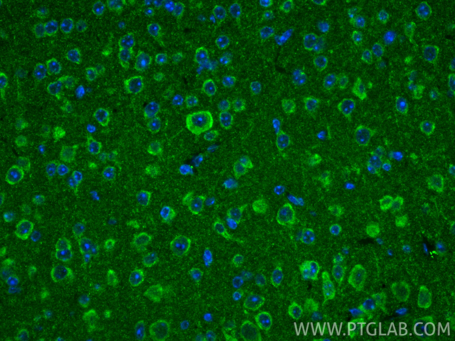 IF Staining of mouse brain using 32273-1-AP (same clone as 32273-1-PBS) Immunofluorescence (IF) / fluorescent staining of mouse brain tissue using TMEM205 Polyclonal antibody (32273-1-AP)