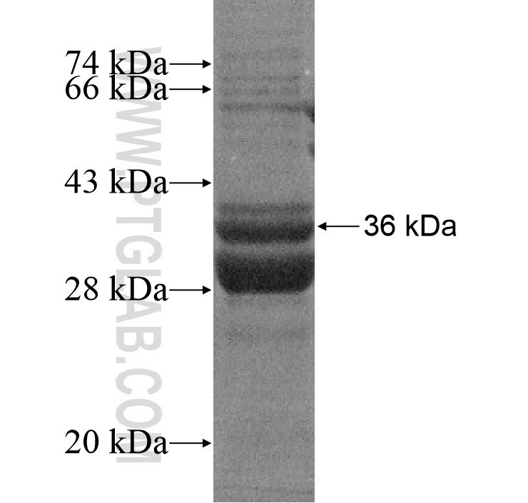 TMEM205 fusion protein Ag15211 SDS-PAGE TMEM205 fusion protein Ag15211 SDS-PAGE