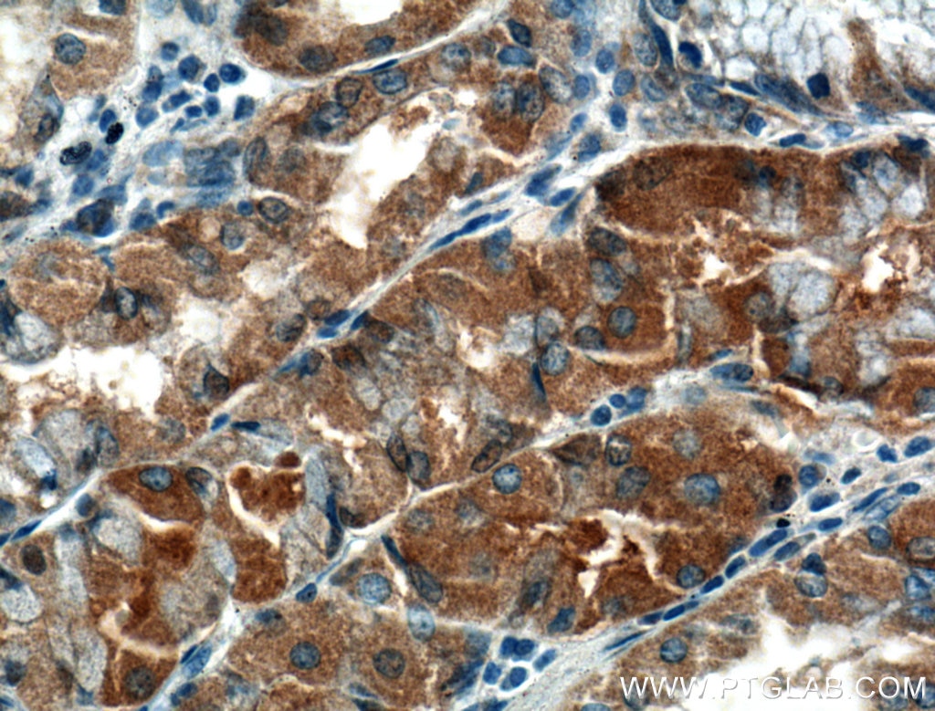 Immunohistochemistry (IHC) staining of human stomach tissue using TMEM208 Polyclonal antibody (23882-1-AP)