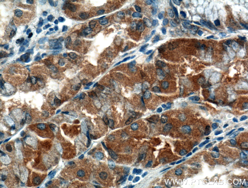 Immunohistochemistry (IHC) staining of human stomach tissue using TMEM208 Polyclonal antibody (23882-1-AP)