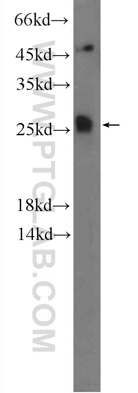 Western Blot (WB) analysis of mouse brain tissue using TMEM208 Polyclonal antibody (23882-1-AP)