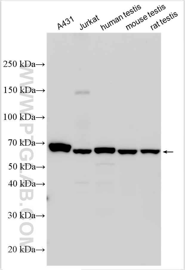 Various lysates were subjected to SDS PAGE followed by western blot with 33203-1-AP (TMEM209 antibody) at dilution of 1:4000 incubated at room temperature for 1.5 hours. Western Blot (WB) analysis of various lysates using TMEM209 Polyclonal antibody (33203-1-AP)