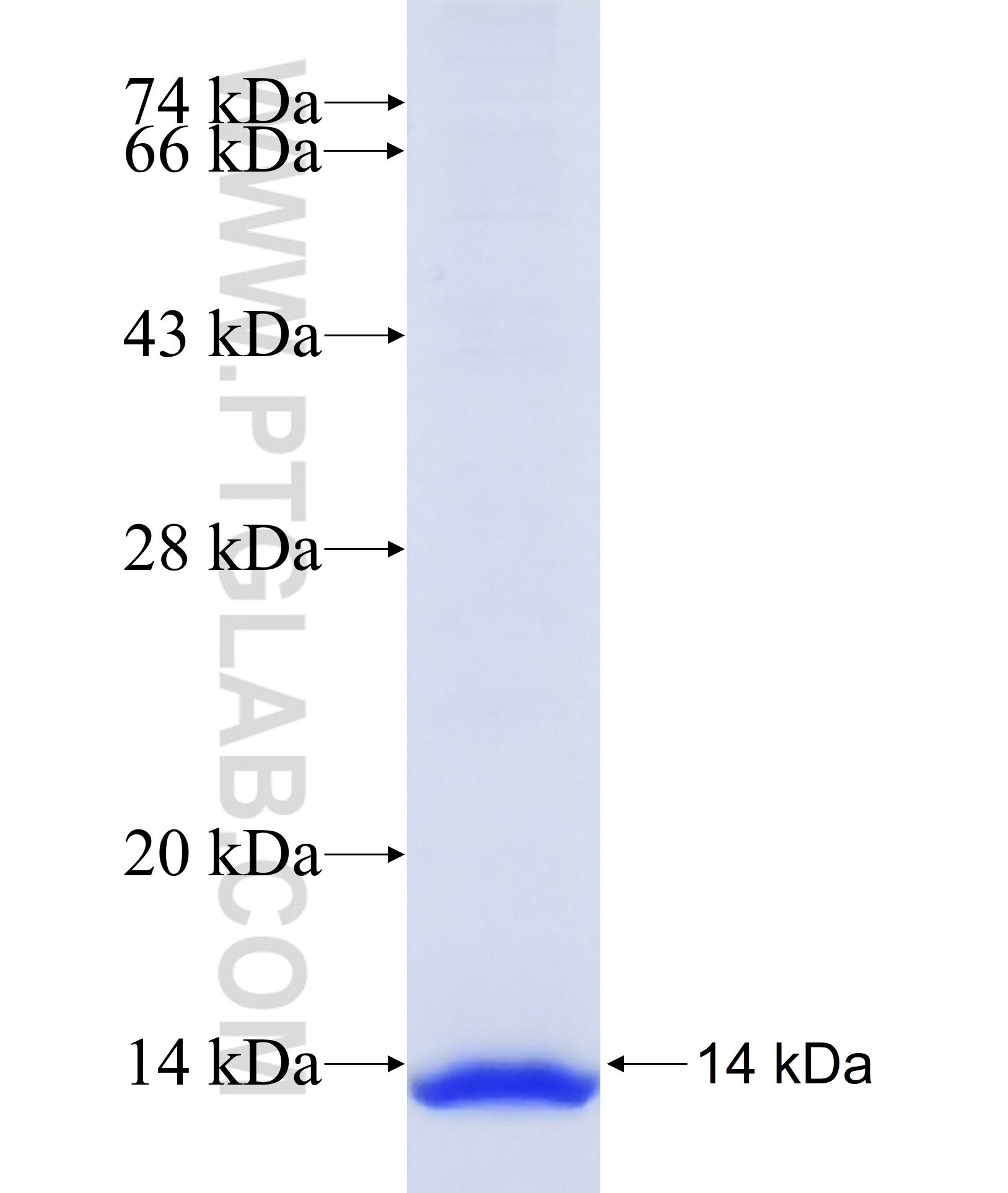 TMEM212 fusion protein Ag37150 SDS-PAGE TMEM212 fusion protein Ag37150 SDS-PAGE