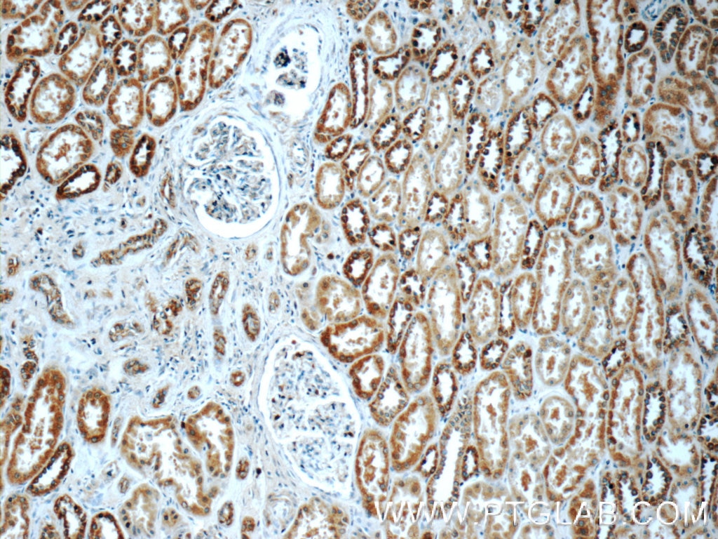 Immunohistochemistry (IHC) staining of human kidney tissue using TMEM213 Polyclonal antibody (24927-1-AP)