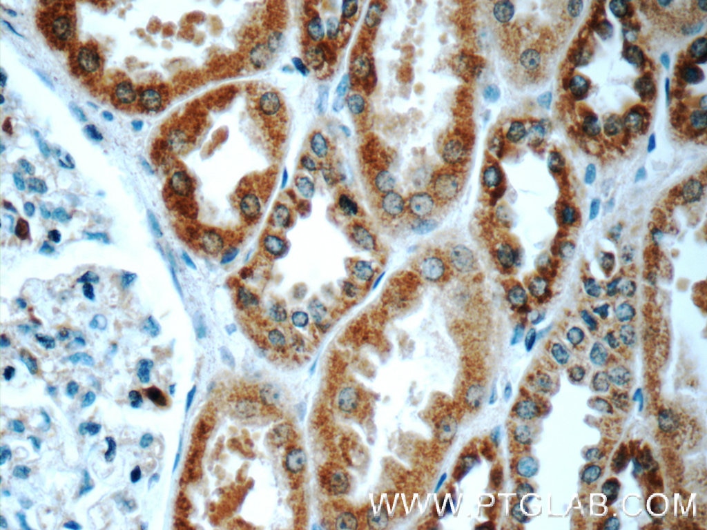 Immunohistochemistry (IHC) staining of human kidney tissue using TMEM213 Polyclonal antibody (24927-1-AP)