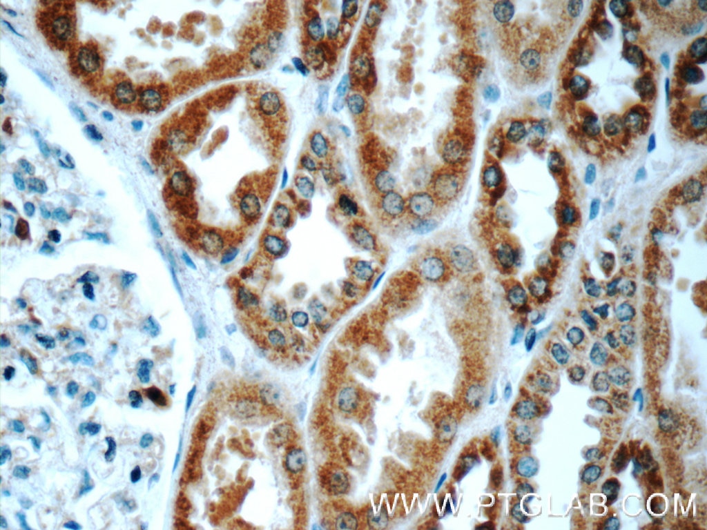 IHC staining of human kidney using 24927-1-AP