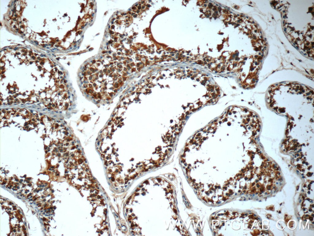Immunohistochemistry (IHC) staining of human testis tissue using TMEM213 Polyclonal antibody (24927-1-AP)