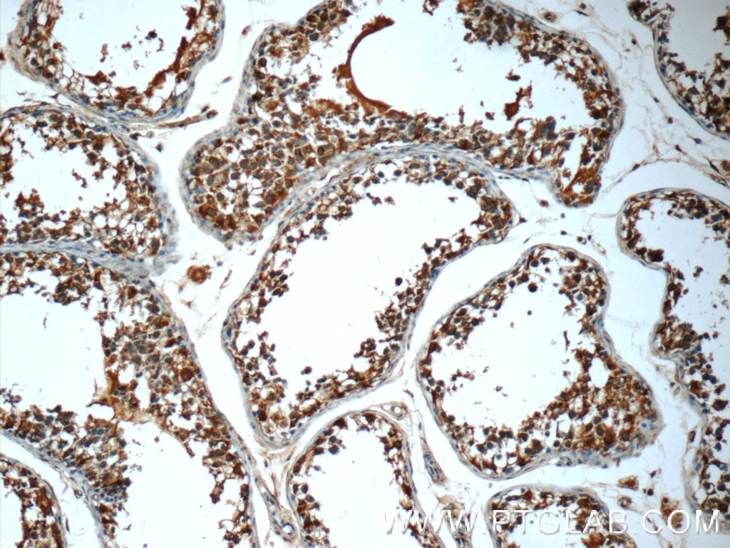 IHC staining of human testis using 24927-1-AP