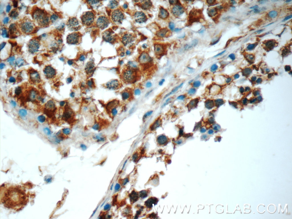 Immunohistochemistry (IHC) staining of human testis tissue using TMEM213 Polyclonal antibody (24927-1-AP)