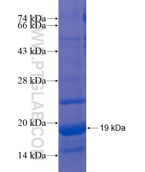 TMEM213 fusion protein Ag21572 SDS-PAGE