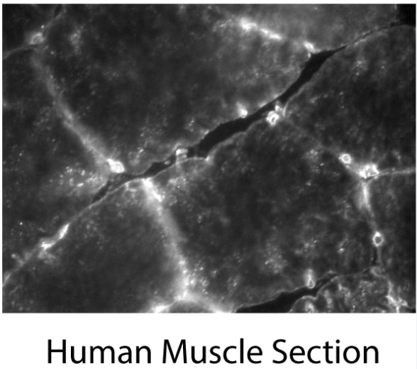 Immunofluorescence (IF) / fluorescent staining of human muscle slides using TMEM214 Polyclonal antibody (20125-1-AP)