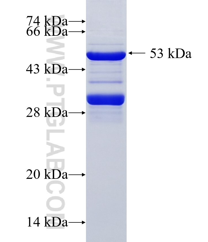 TMEM215 fusion protein Ag36672 SDS-PAGE