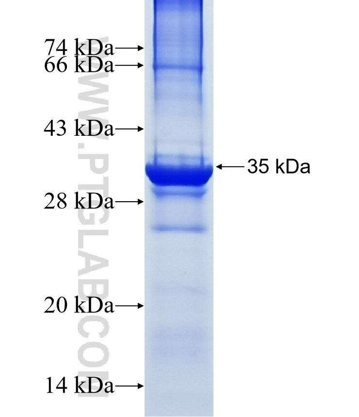 TMEM217 fusion protein Ag15587 SDS-PAGE