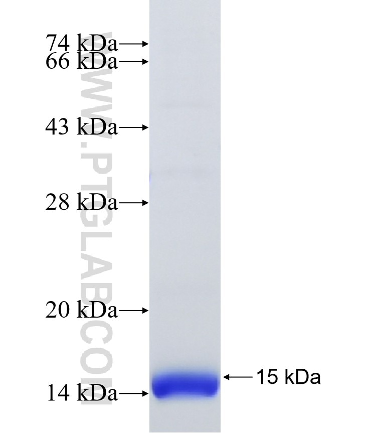 TMEM218 fusion protein Ag40896 SDS-PAGE