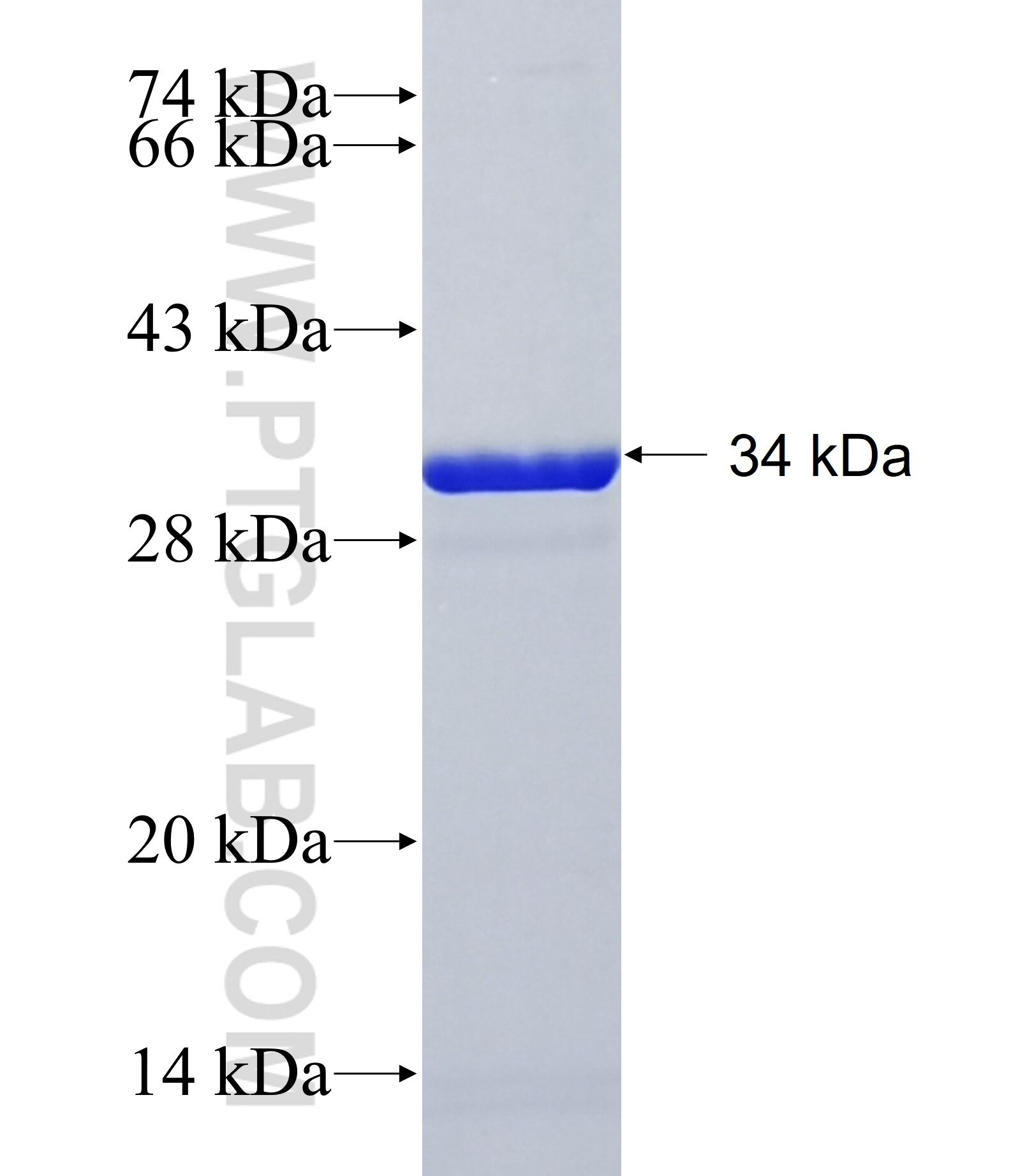 TMEM218 fusion protein Ag41011 SDS-PAGE