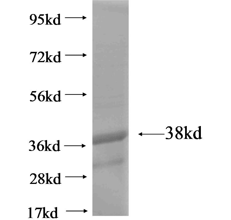 TMEM218 fusion protein Ag19225 SDS-PAGE