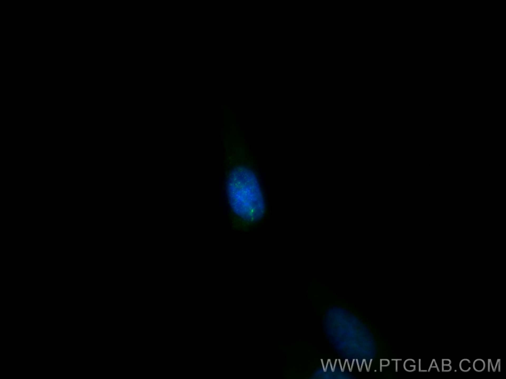 Immunofluorescence (IF) / fluorescent staining of MDCK cells using TMEM231 Polyclonal antibody (23731-1-AP)