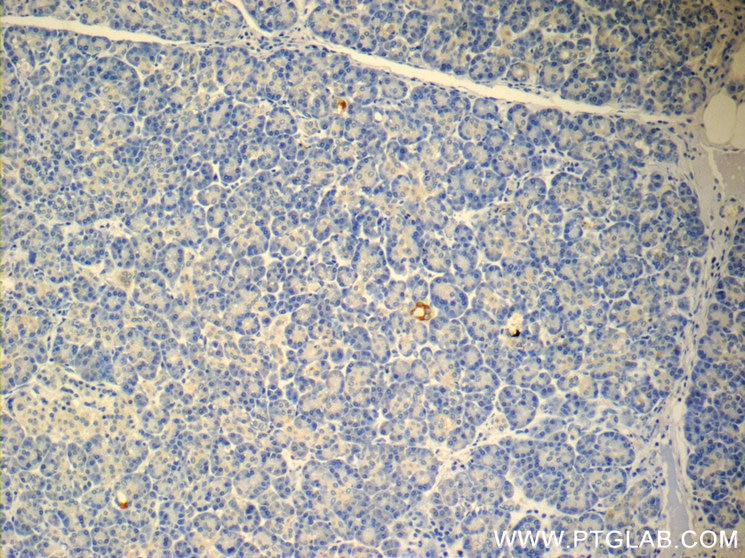 Immunohistochemistry (IHC) staining of human pancreas tissue using TMEM231 Polyclonal antibody (23731-1-AP)
