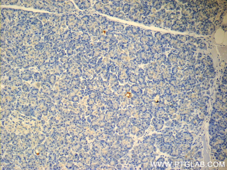 IHC staining of human pancreas using 23731-1-AP