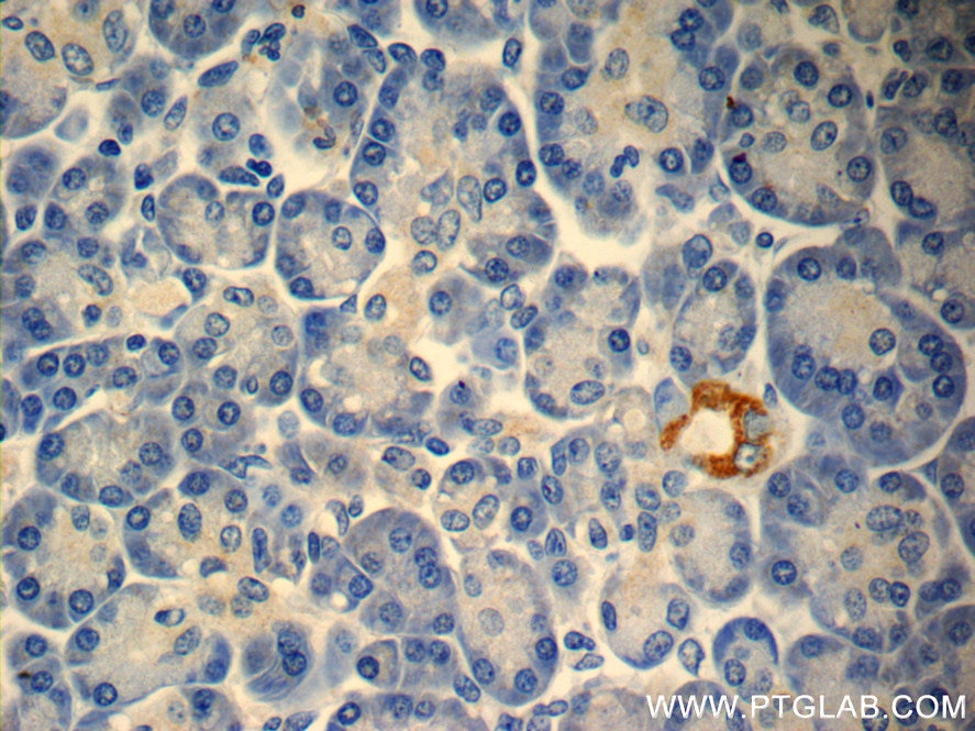 Immunohistochemistry (IHC) staining of human pancreas tissue using TMEM231 Polyclonal antibody (23731-1-AP)