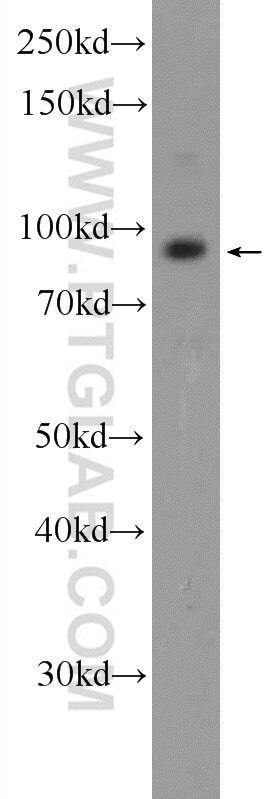 Western Blot (WB) analysis of HeLa cells using TMEM24 Polyclonal antibody (25507-1-AP)