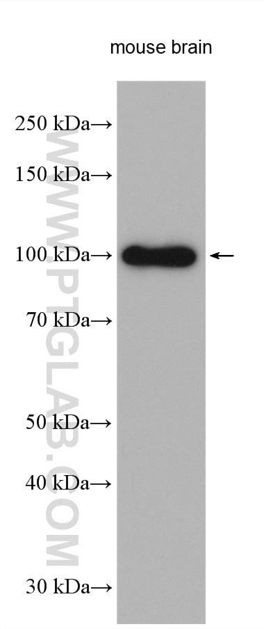 WB analysis using 25507-1-AP Western Blot (WB) analysis of various lysates using TMEM24 Polyclonal antibody (25507-1-AP)