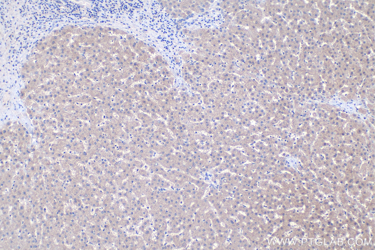 Immunohistochemistry (IHC) staining of human liver tissue using TMEM25 Polyclonal antibody (24361-1-AP)