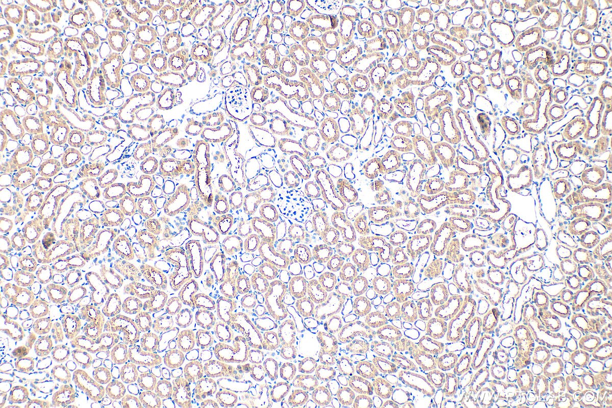 Immunohistochemistry (IHC) staining of mouse kidney tissue using TMEM258 Polyclonal antibody (31525-1-AP)