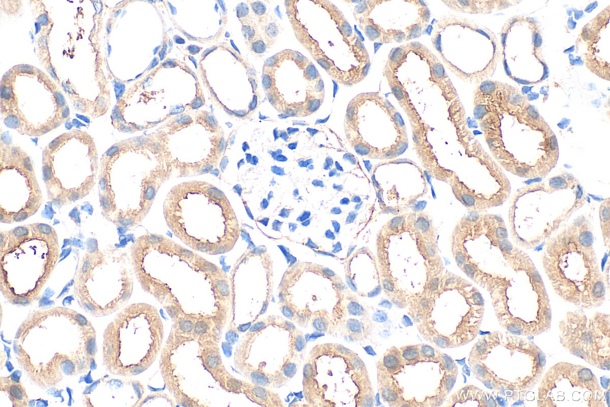 Immunohistochemistry (IHC) staining of mouse kidney tissue using TMEM258 Polyclonal antibody (31525-1-AP)