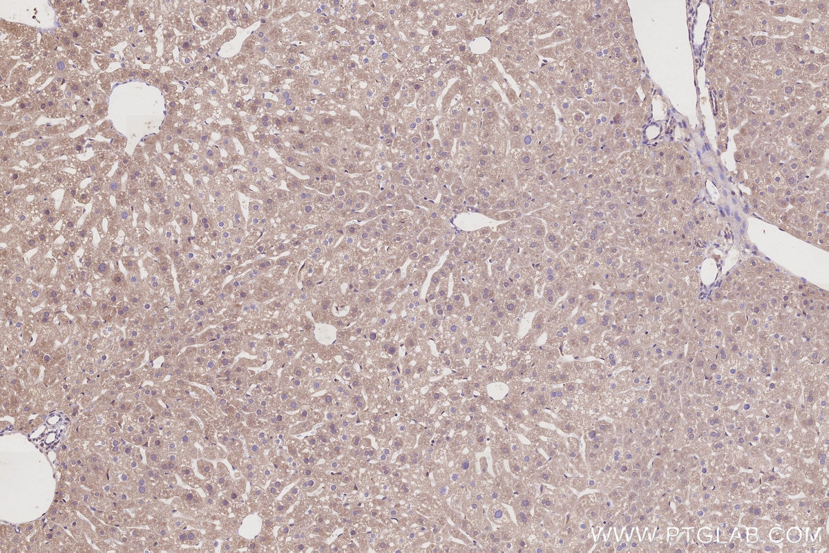 Immunohistochemistry (IHC) staining of mouse liver tissue using TMEM258 Polyclonal antibody (31525-1-AP)
