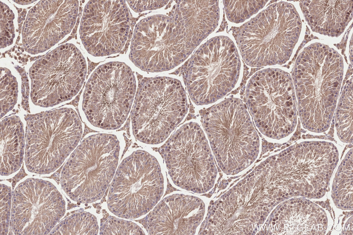 Immunohistochemistry (IHC) staining of rat testis tissue using TMEM258 Polyclonal antibody (31525-1-AP)
