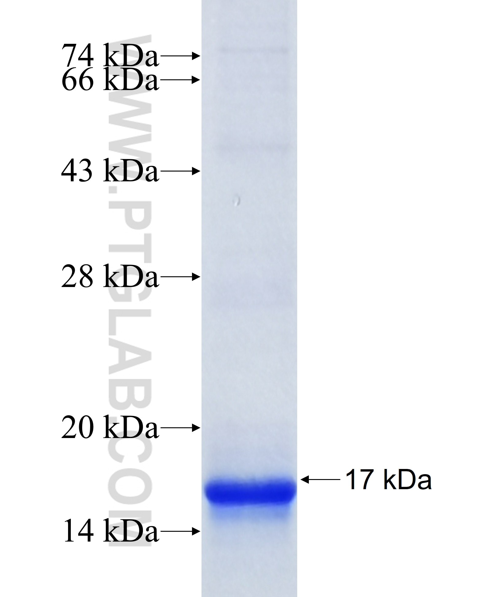 TMEM258 fusion protein Ag36001 SDS-PAGE TMEM258 fusion protein Ag36001 SDS-PAGE