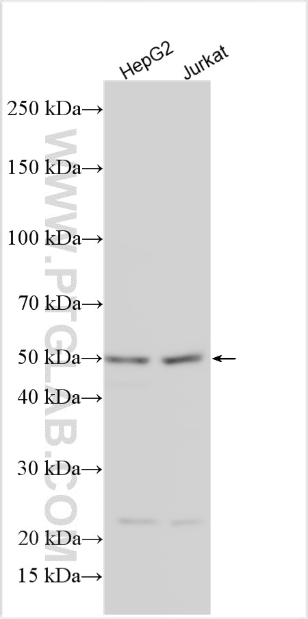 WB analysis using 27267-1-AP Western Blot (WB) analysis of various lysates using TMEM26 Polyclonal antibody (27267-1-AP)