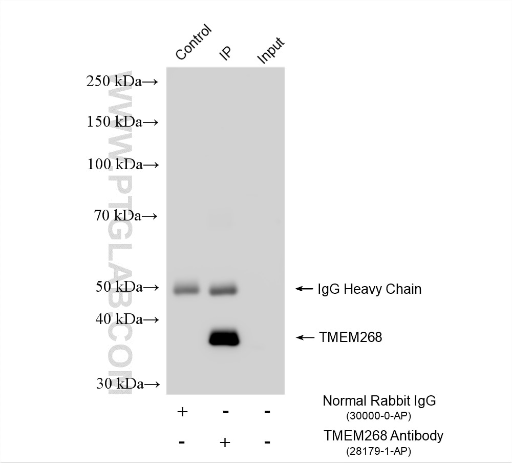 Immunoprecipitation (IP) experiment of T-47D cells using TMEM268 Polyclonal antibody (28179-1-AP)