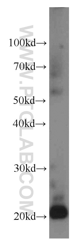 Western Blot (WB) analysis of mouse kidney tissue using TMEM27 Polyclonal antibody (14571-1-AP)