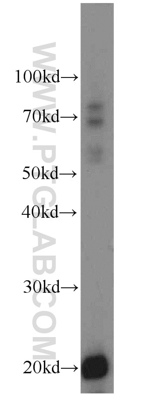 Western Blot (WB) analysis of mouse pancreas tissue using TMEM27 Polyclonal antibody (14571-1-AP)